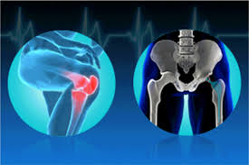 Orthopedics